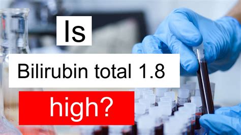 total bilirubin 1.8|is 1.8 bilirubin high.